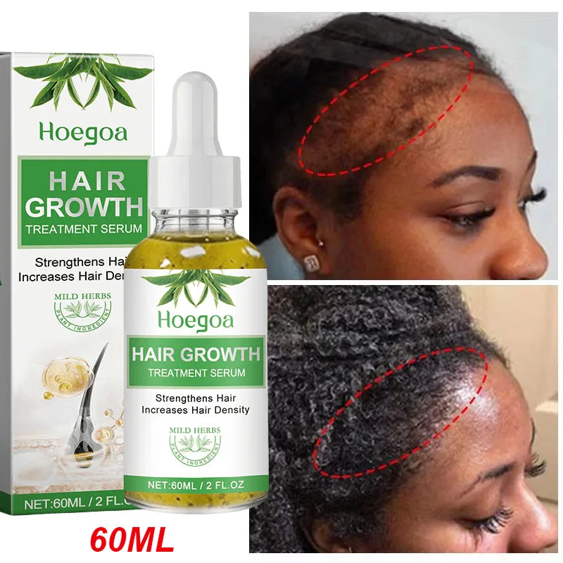 

Fast Hair Growth Oil Rosemary Africa Crazy Traction Alopecia Serum Anti Hair Break Thicken Hair Loss Essential Oil For Man Women