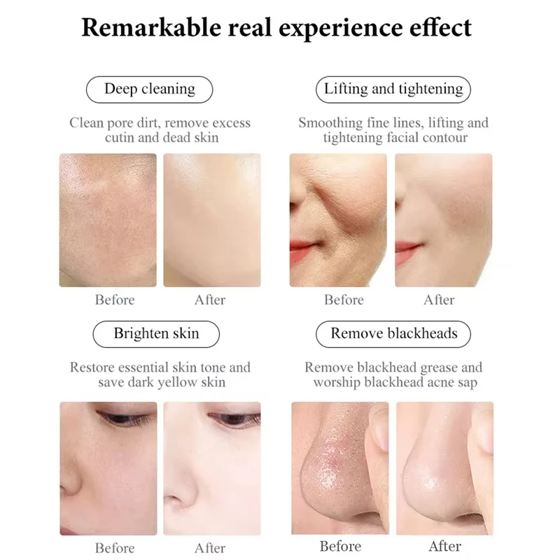 3 IN 1 Macchina di bellezza ad ultrasuoni Lifting facciale ad ultrasuoni Dispositivo di bellezza per massaggio degli occhi Cura della pelle Pulizia dei pori Massaggiatore SPA facciale