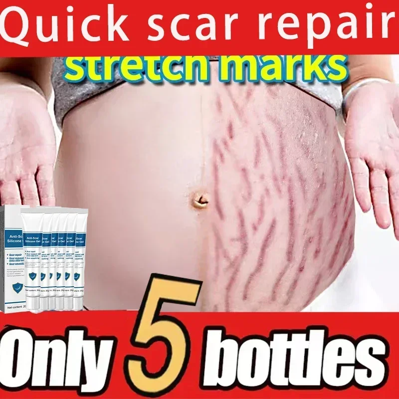 

Eliminate Red White Old Stretch Marks Cream For Pregnancy Postpartum Skin Care Gel