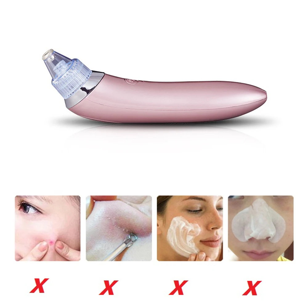 Xn-8030 Powerful Suction Easy To Use High-quality Trending Innovative Must-have Suitable For Sensitive Skin Blackhead Removal