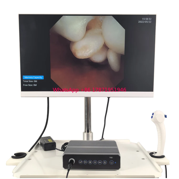 

OEM customization superior quality Full HD Medical Endoscopy Camera System Competitive Price Portable Endoscopy