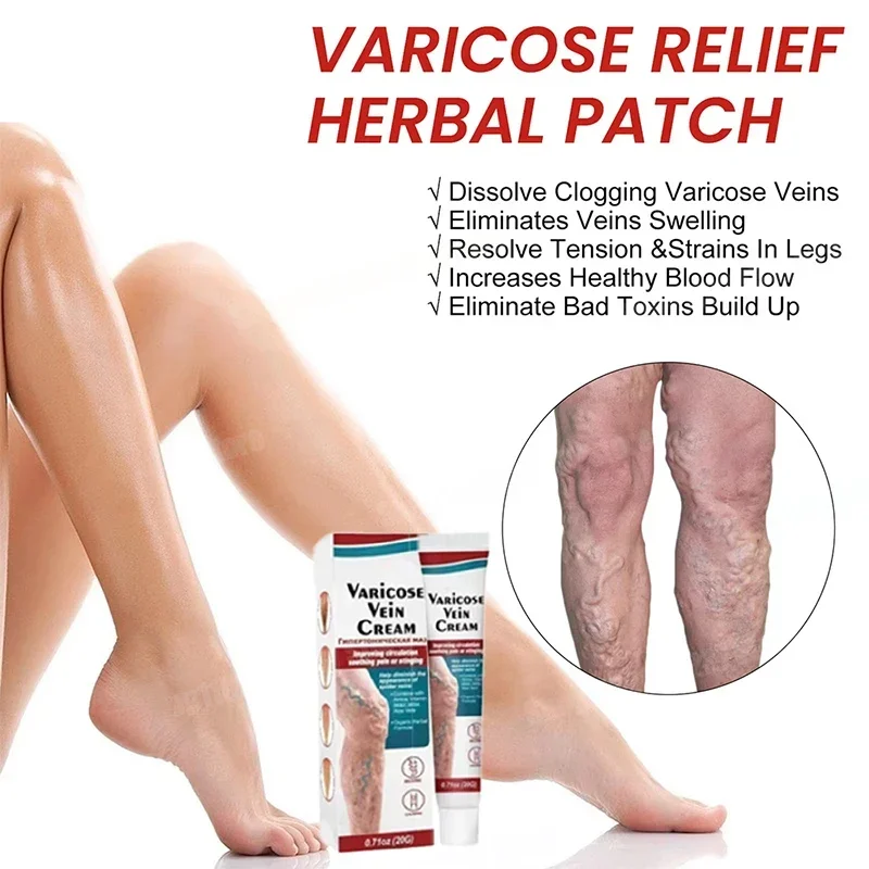 Cream leg skin irritates and soothes venous tension