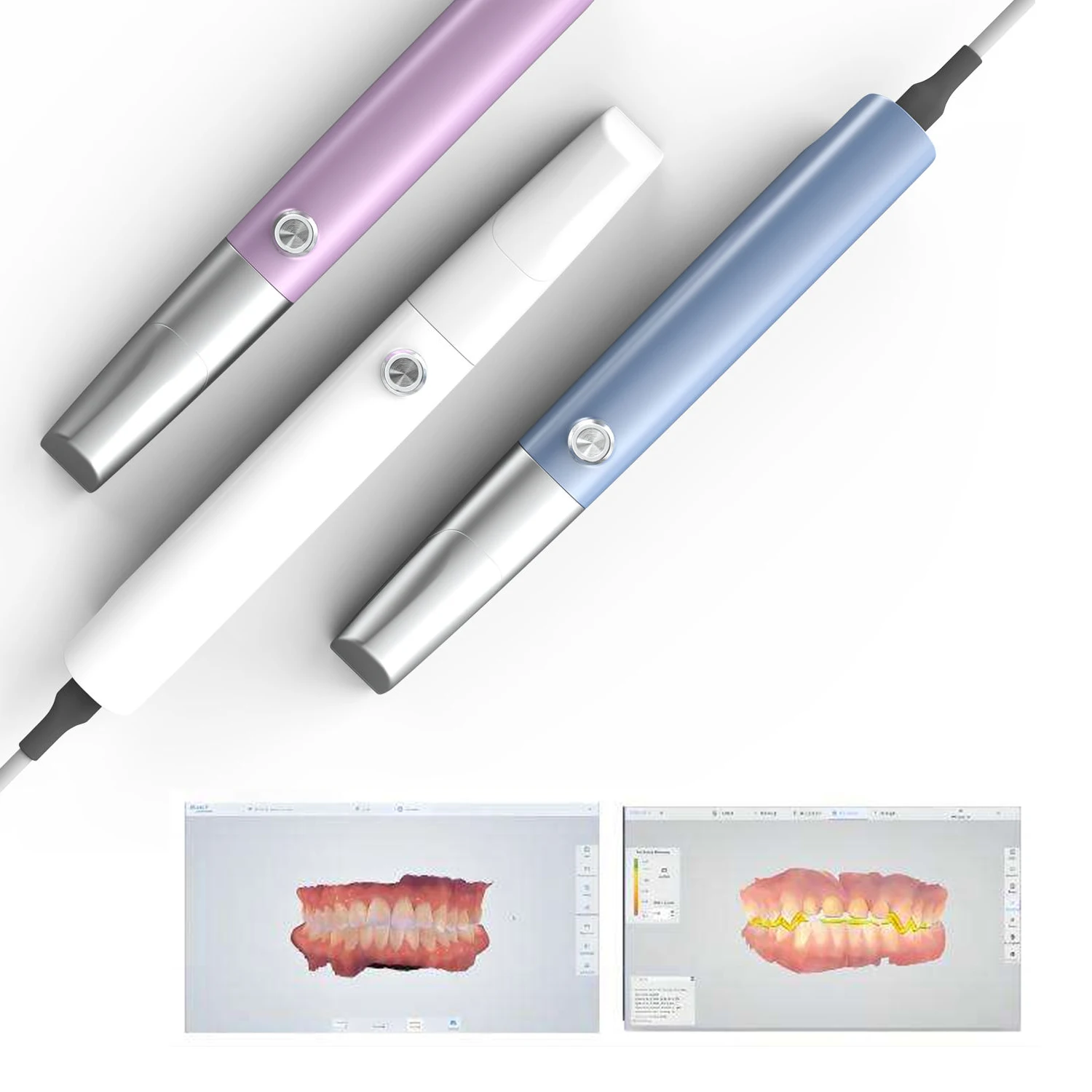Electric High Quality Hot Sale Smart Dental Digital 3D Intra Oral Scanner Class II Top Therapy Equipment Accessory 3-Year
