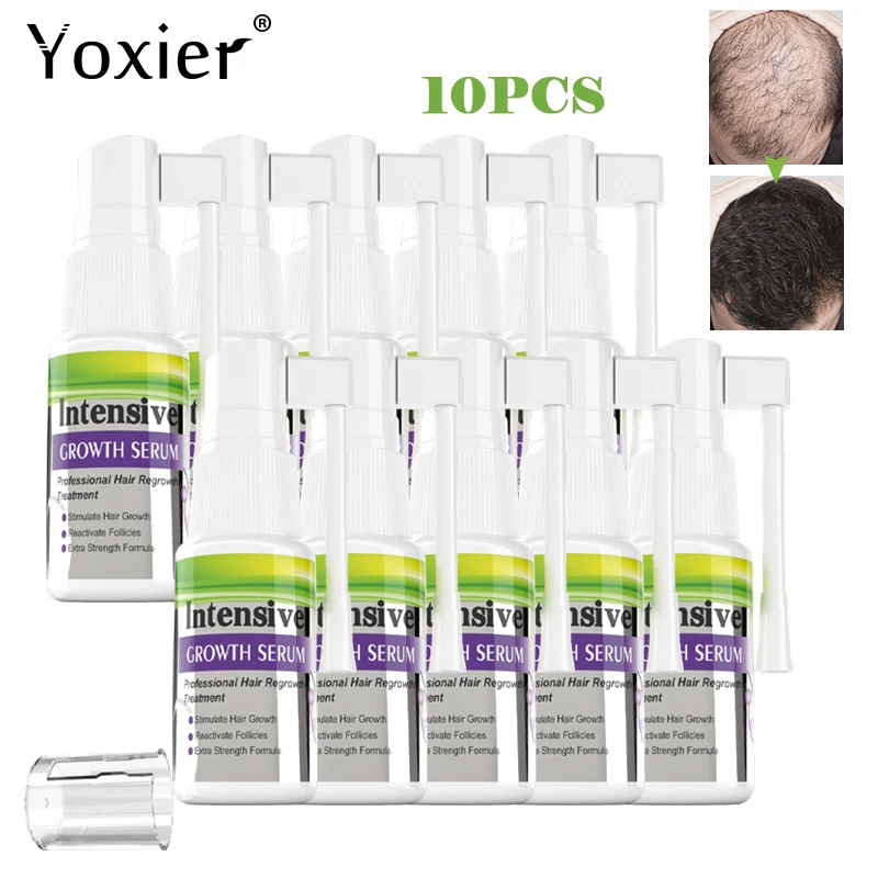 Ginger Hair Growth Serum Spray Anti Hair Loss Liquid Fast Hair Regeneration Damaged Hair Repair Healthy Hair Care 20ML * 10PCS