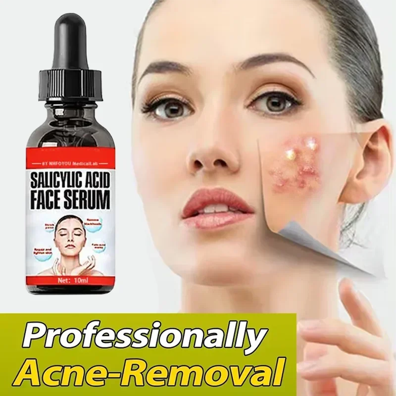 Effective Acne Removal Cream Treatment Acne Scar Shrink Pores Oil Control Whitening Moisturize Face Ginseng Herb Acne Skin Care