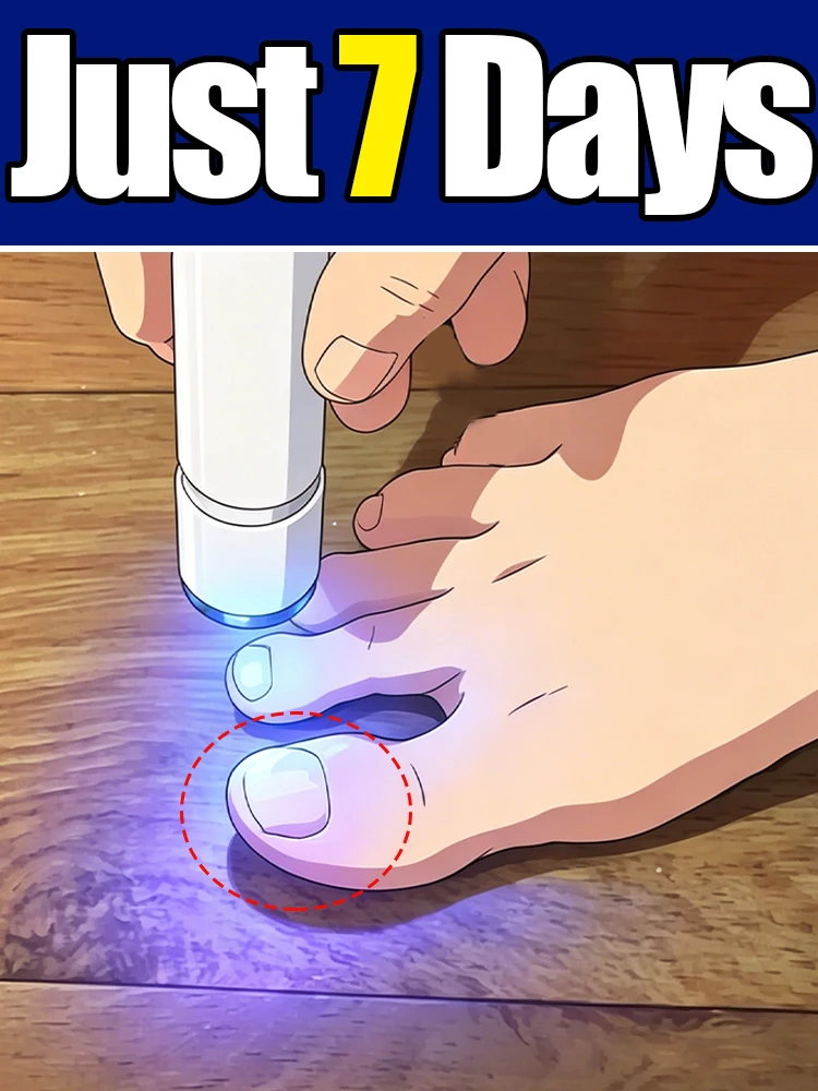 

Multi functional Blue light pen, can be widely used of Pedicure Cleaning nail