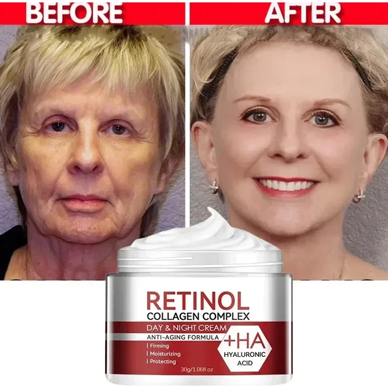 Retinol Collageen Verwijderen Rimpel Gezicht Set Verstevigende Lifting Anti-Aging Serum Vervagen Fijne Lijntjes Oogstok Verbeteren Wallen Huidverzorging