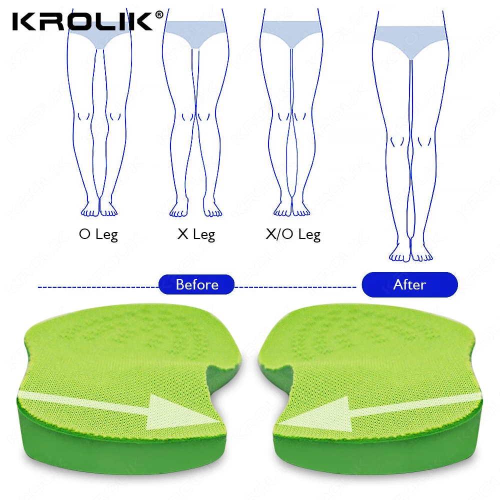 

XO Legs Orthotic Shoes Insoles For Women Van Flat Foot Arch Support Orthotics Insole Outer Eight Foot Orthotic Correct Shoe Pads