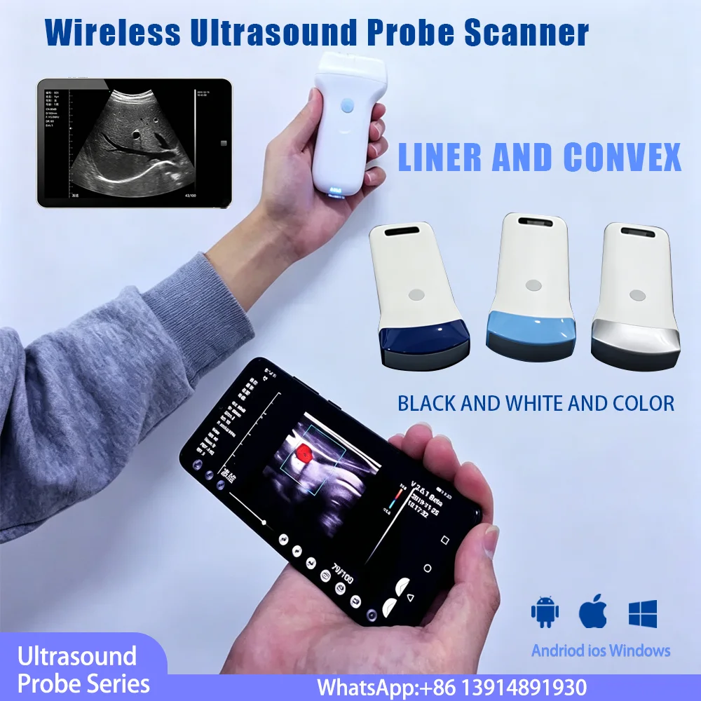 Wireless Ultrasound Probe Scanner WIFI Portable Pocket Machine Support iOS Android Windows Carry USG WiFi Ultrasound Probe