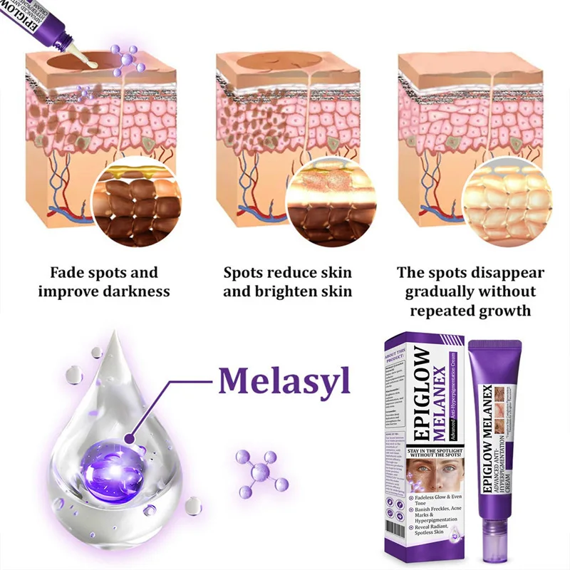Dark Spots Removal Cream Facial Whitening Freckle Acne Mark Pigmentation Removal Melanin Skin Correction Brighten Care Products - Image 6