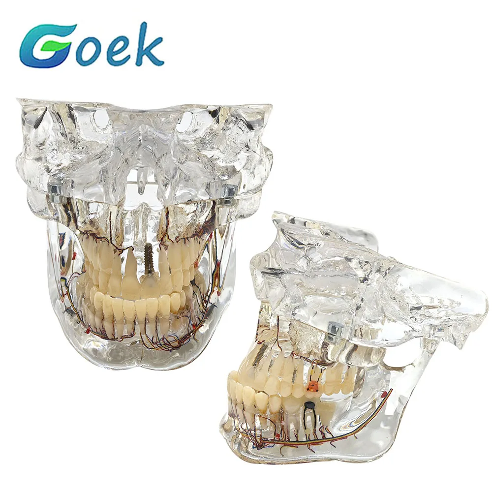 Dental Clear Pathological Model With Nerve C13 Teaching Resources Dentist Accessories Tools Model Teeth Dentistry