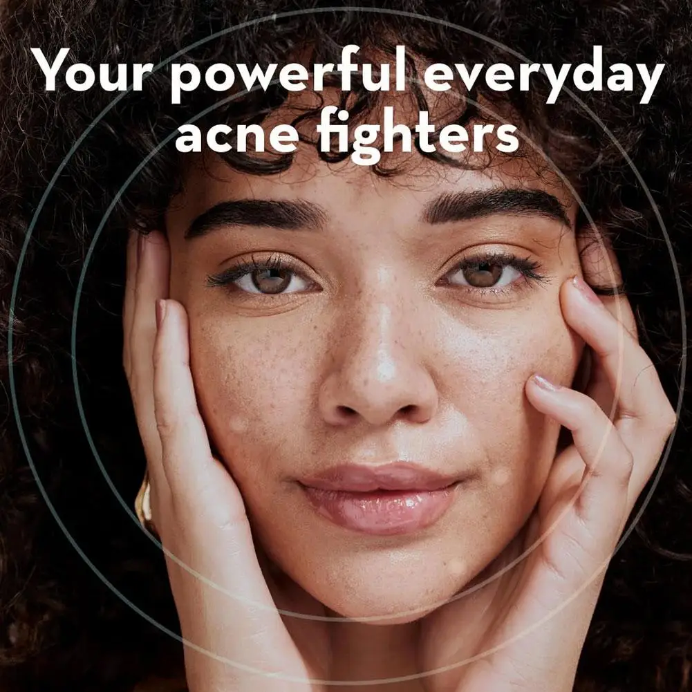 صندوق دائري من البولي ايثيلين لقع حب الشباب ثنائية اللون 360 قطعة كبيرة الحجم غير مرئية مزيج حب الشباب بقع الرؤوس السوداء والعيوب #4