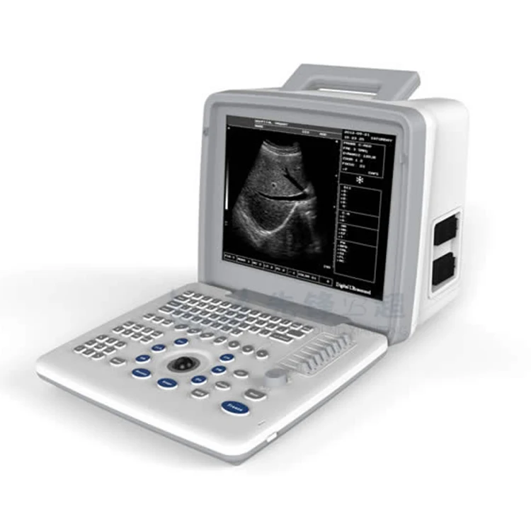 

XF300 VET Full Digital LED Portable VET Ultrasound Scanner Medical Ultrasound Instruments Pet Ultrasound Scanner