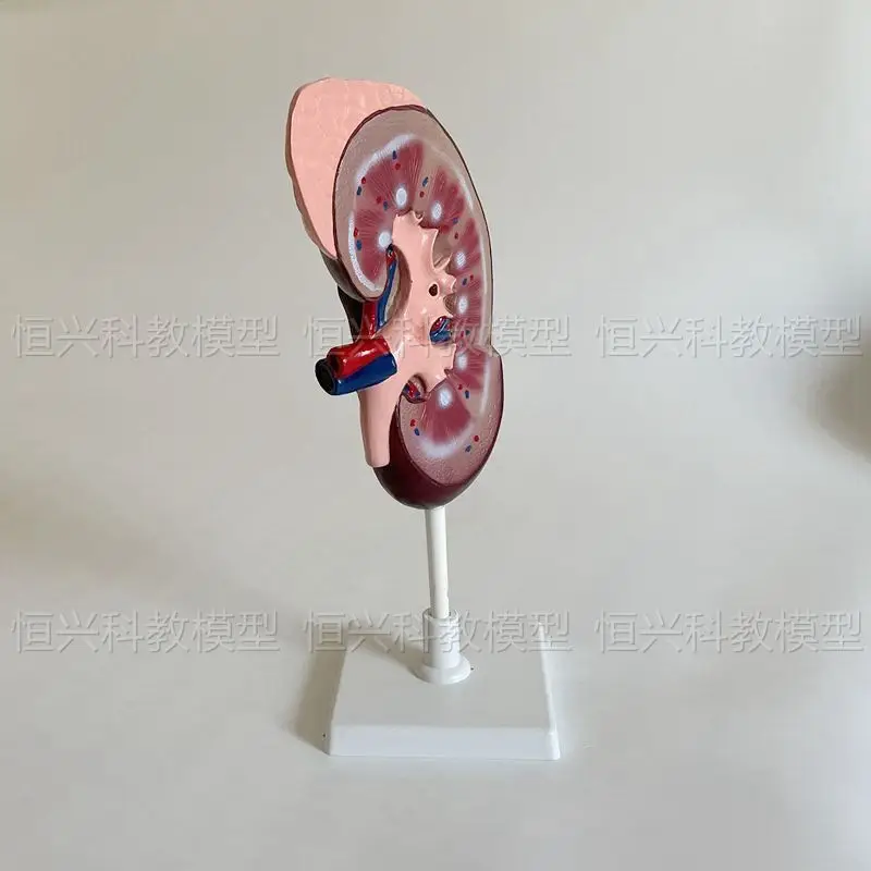 Renal model, adrenal artery and vein vascular teaching instrument, anatomical specimen for medical students