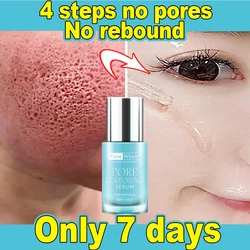 FlowWeek Skin Balancing Pore Minimizing Serum for Combination and Oily Skin Minimize Enlarged Pores Anti-Blemish Essence