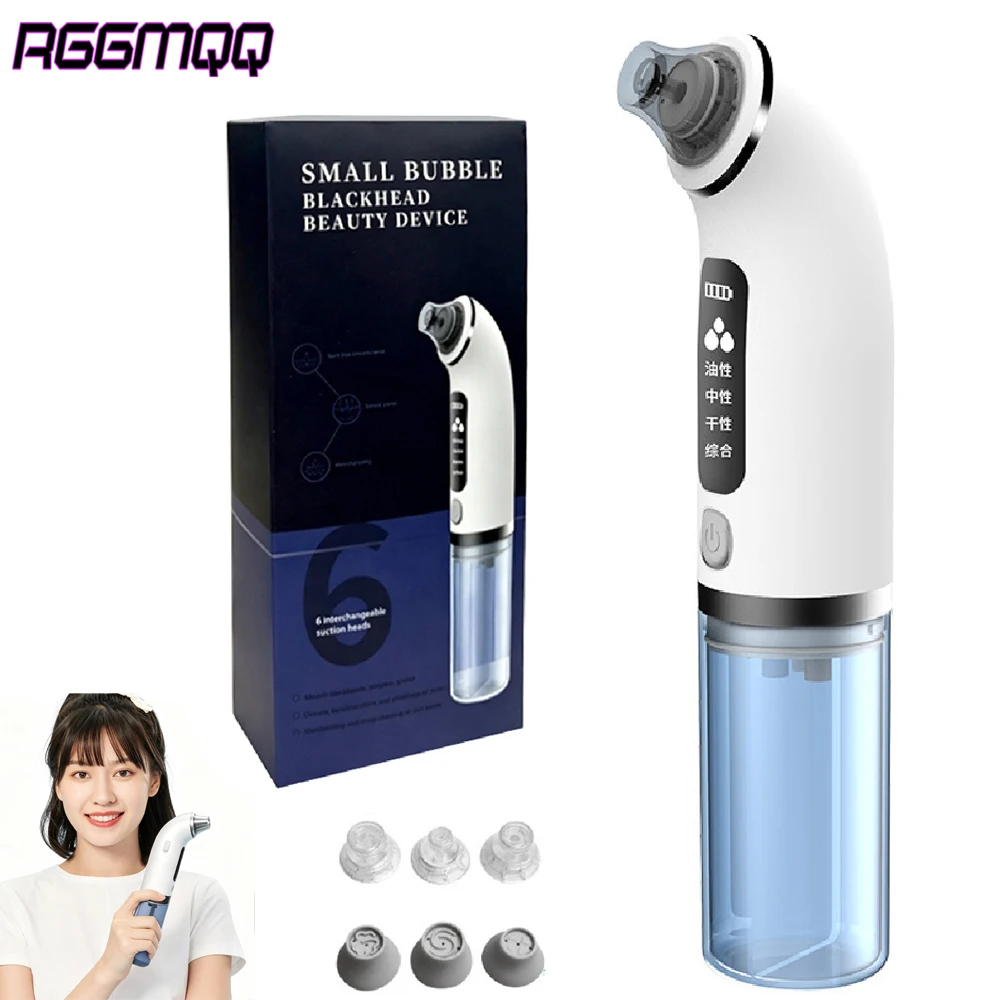 Electric USB-C Pore Vacuum Blackhead Remover 6 Probes 4 Suction Levels Portable Comedone Extractor For  Acne Whitehead Cleansing