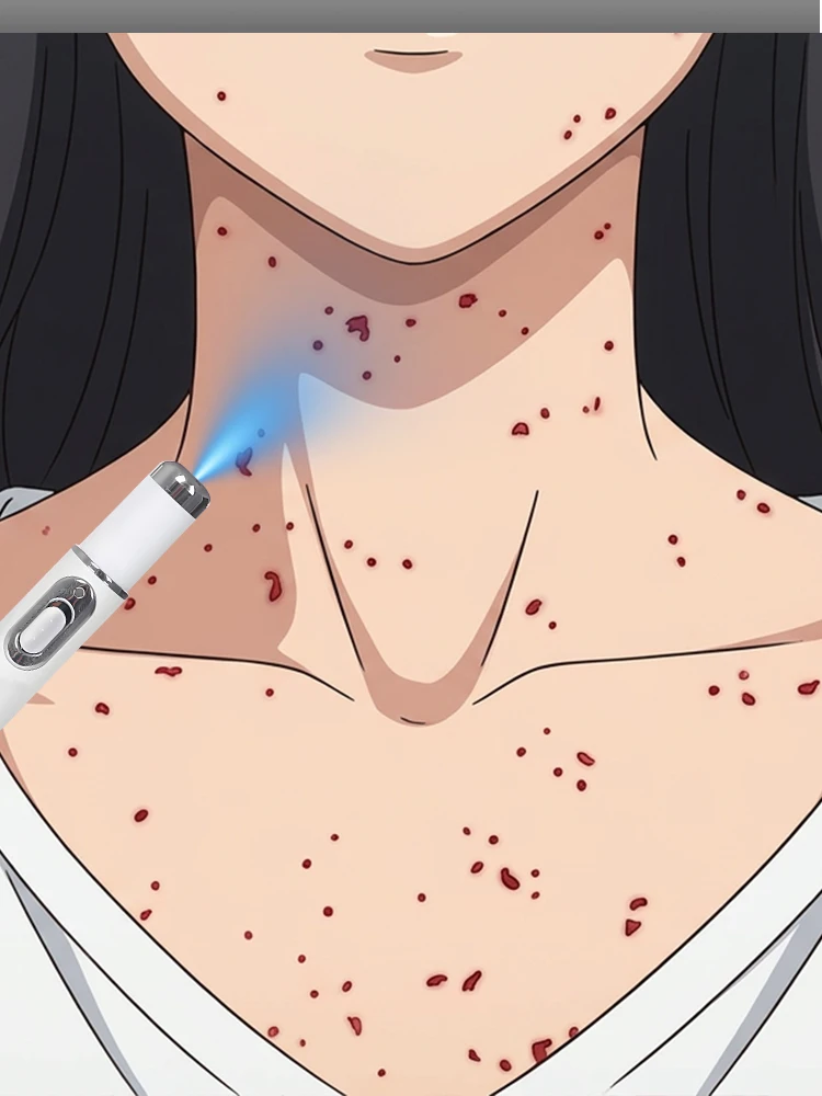 

Набор для удаления кожных меток и очищения кожи, для удаления меток диаметром 2-4 мм, инструмент для удаления бородавок, родинок и кожных меток, уход за кожей шеи, унисекс