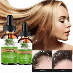 Hair Growth Oil Rosemary Essential Oil Anti-frizz Anti Hair Loss Hairs Smooth Serum Hairs Care Hairs Loss Treatments New Fashion
