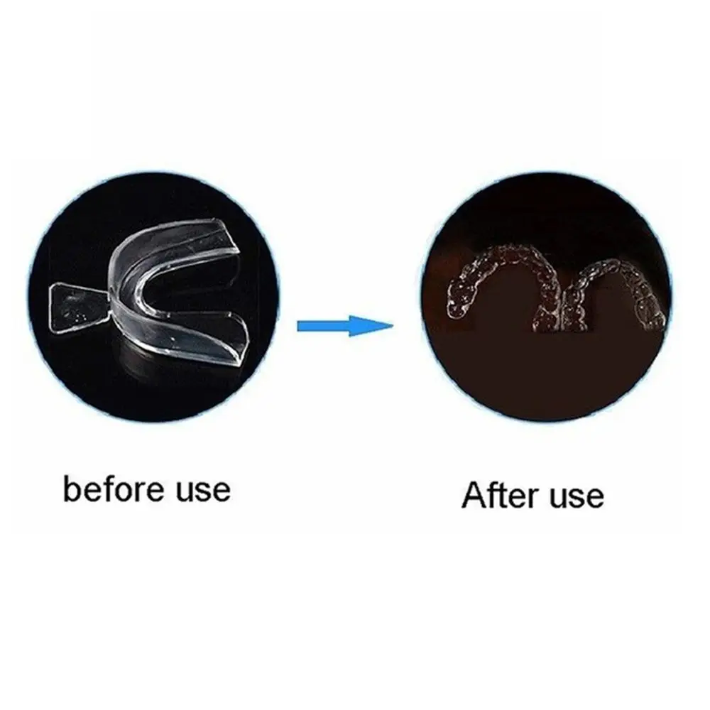 وقف طحن الأسنان الشخير الأسنان الحرس صريف الأسنان حامي الأسنان الأسنان الشخير وقف حامي الفم مكافحة لدغة الأسنان الحرس الأسنان يغطي #5