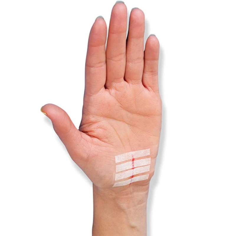 Sterile Strip Scar Away Acne Scar Marks Remover Sterile First Aid Travel Wound Skin Closures Medical Surgical Adhesive