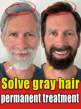 순수 천연 안티 화이트닝 에센스, 백발을 제거하고 머리카락을 뿌리부터 검게 만듭니다.