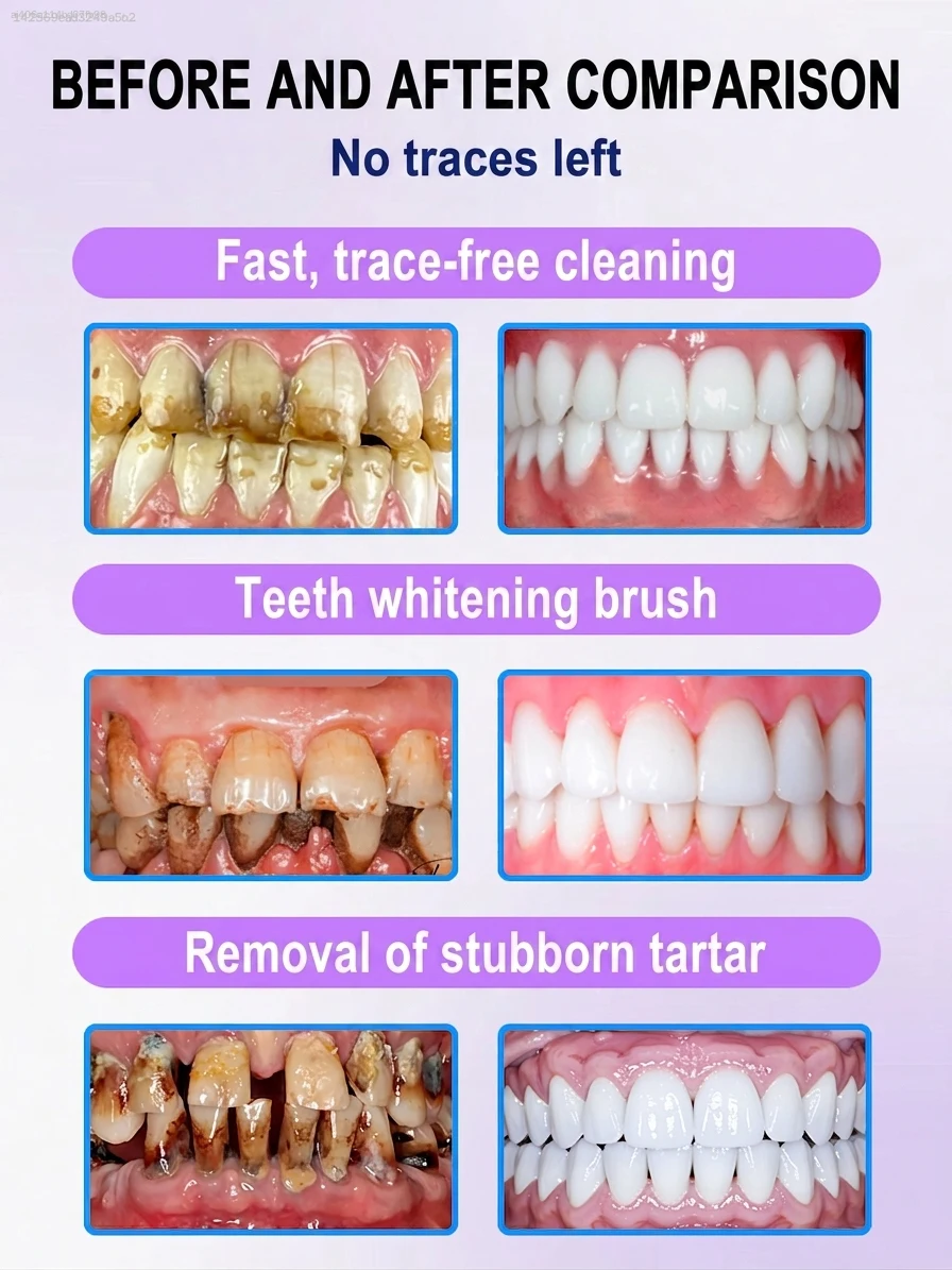 V34 퍼플 치아 미백 펜, 커피 및 담배 얼룩 제거용 - Teeth Whitening Gel Pen 리뷰 및 가격