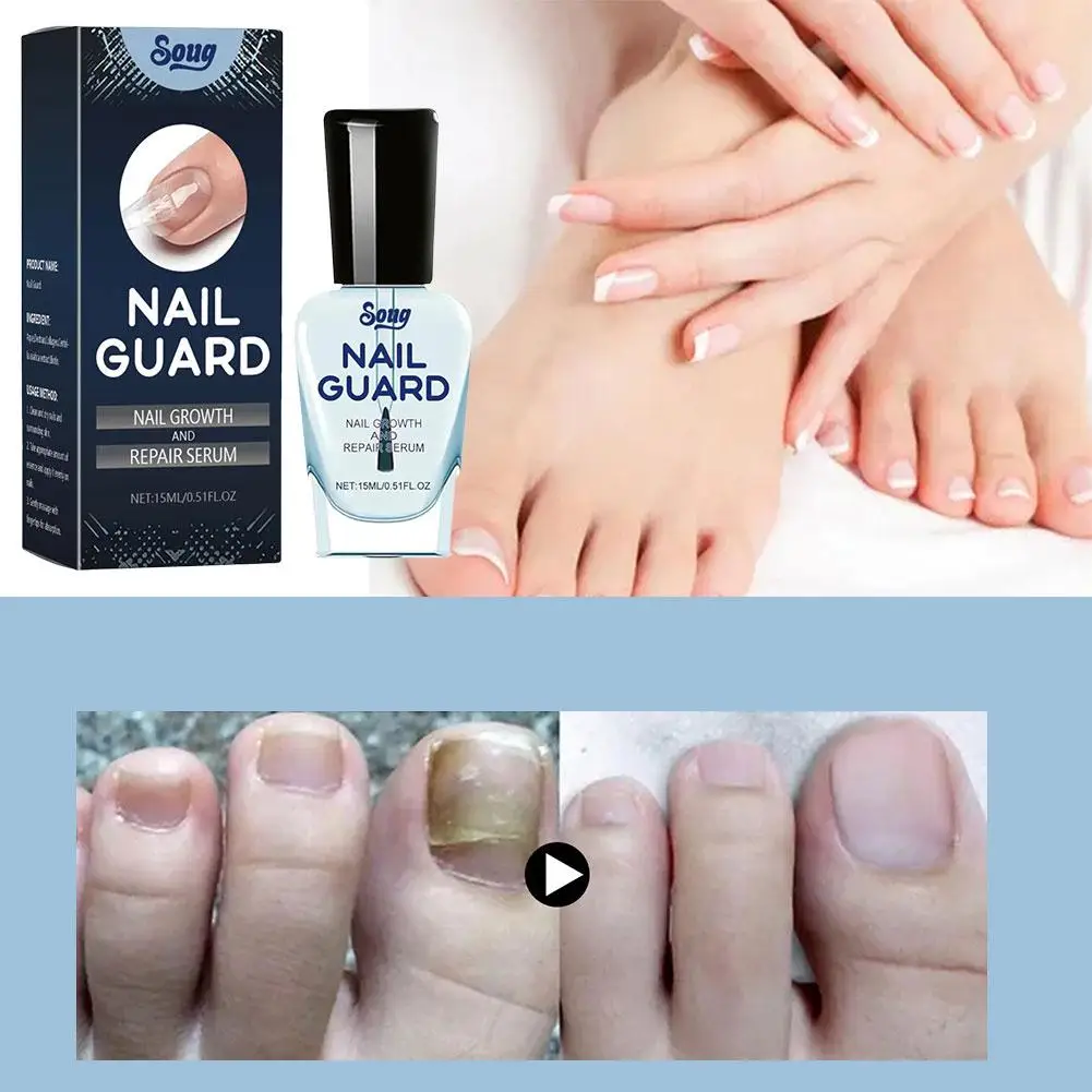 Nail Repairing Liquid Nail Strengthener Nourishing Cream Soft Shining Nail Repair Serum For Home Finger Toe Nail Care P8z0