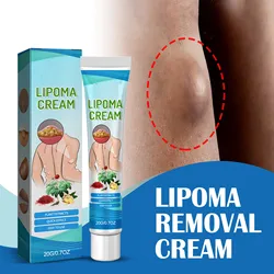 South Moon Lipoma Removal Cream Treatment Skin Swelling Lipolysis Fat Lump Cellulite Elimination Lump Nodule Smoothing Ointment