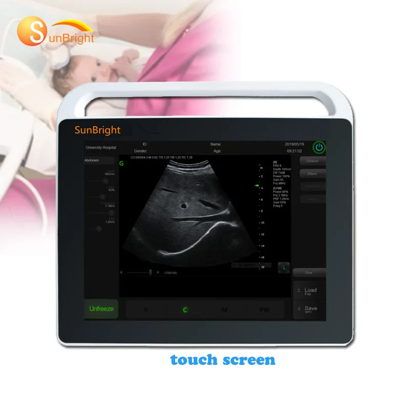 CE Medical ultrasound instruments Cheapest price Ultrasonido High resolution portable tablet touch screen handheld ultrasound