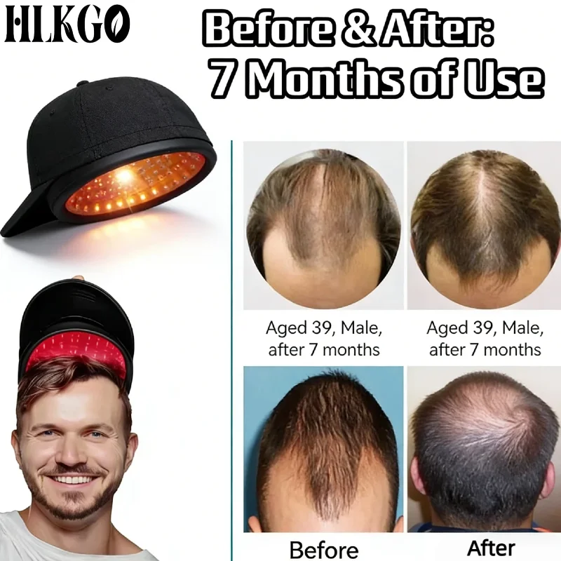 Best Red Light Infrared Cap for Hair Regrowth Thinning Anti Hair Loss Anxiety Stress Migraine Relief Scalp Relax Massager