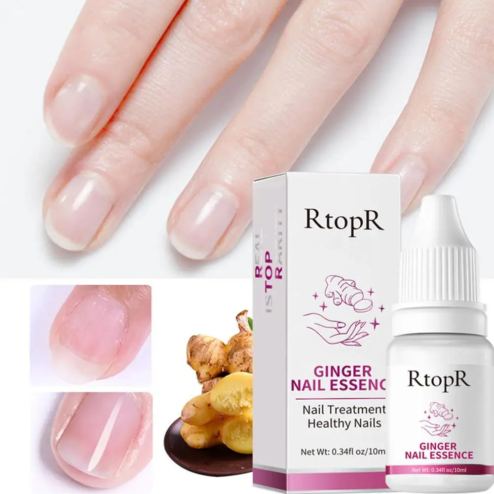 10ml Ginger Nail Essence Nourishing Rough Nails Anti Paronychia Thicken Crack Nail Fungal Nail Treatment Essence Hand Foot CARE