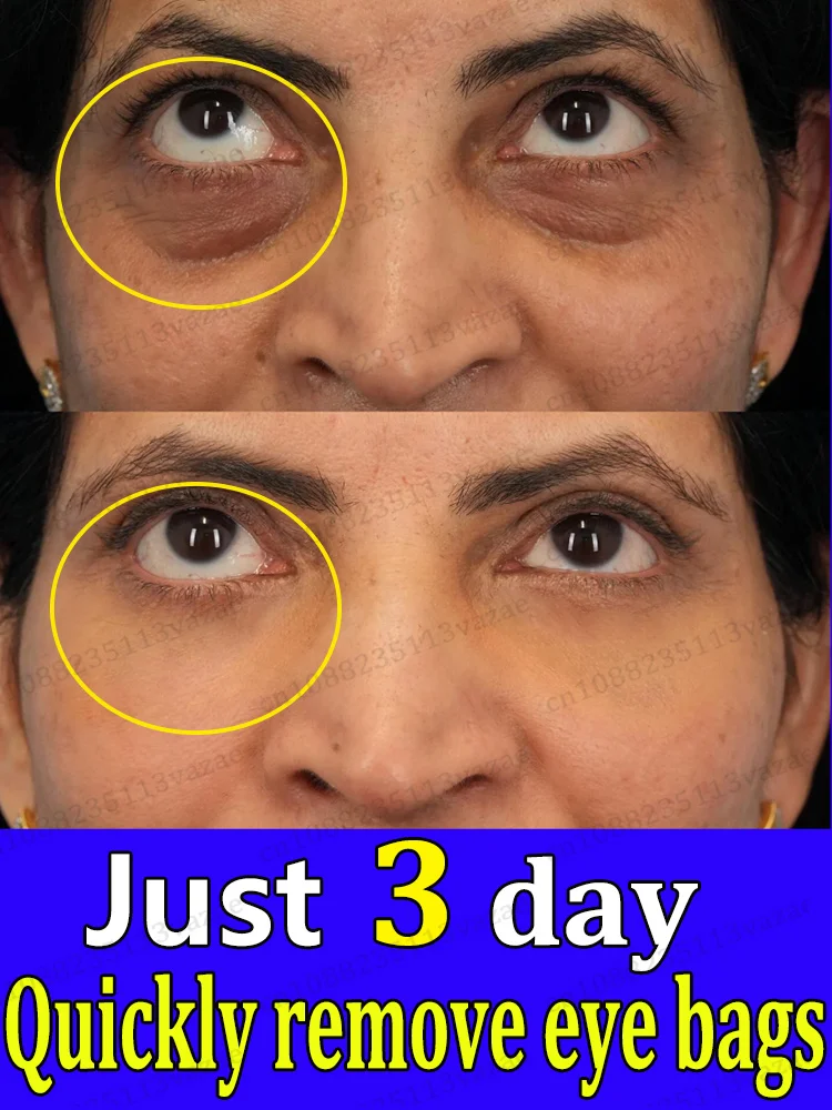 2025 Najlepiej sprzedające się produkty, które sprawią, że optycznie optycznie o 20 lat młodszy