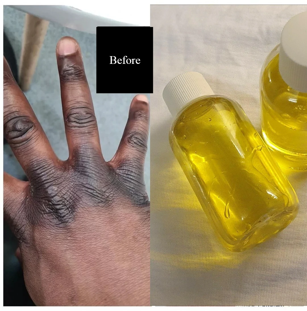 

Dark knuckles remover Oil