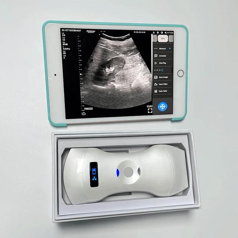 High Quality 192 element Wireless Usb Ultrasound Probe Ultrasound Machine Cheap Price