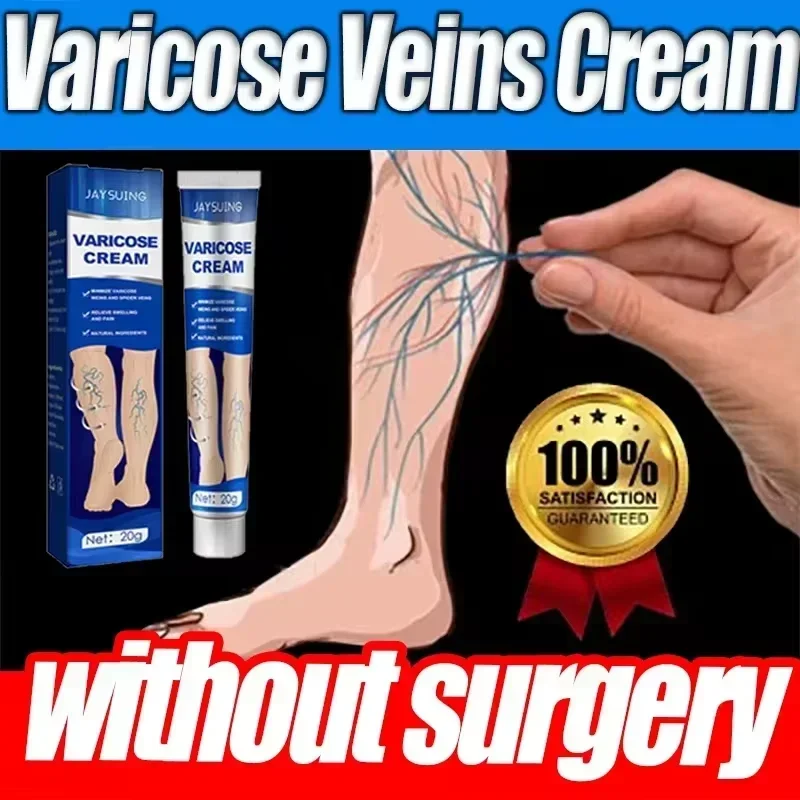 

1ST Skin Care Cream for Varicose Veins Eliminate Vasculitis Phlebitis To Relieve Spider Leg Pain Treatment Herbal Creams