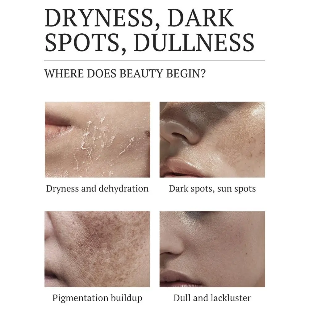 Brightening Dark Spot Cream Pigmentation Removal Melanin Skin Correction Care Moisturizing Skincare Cream view 6