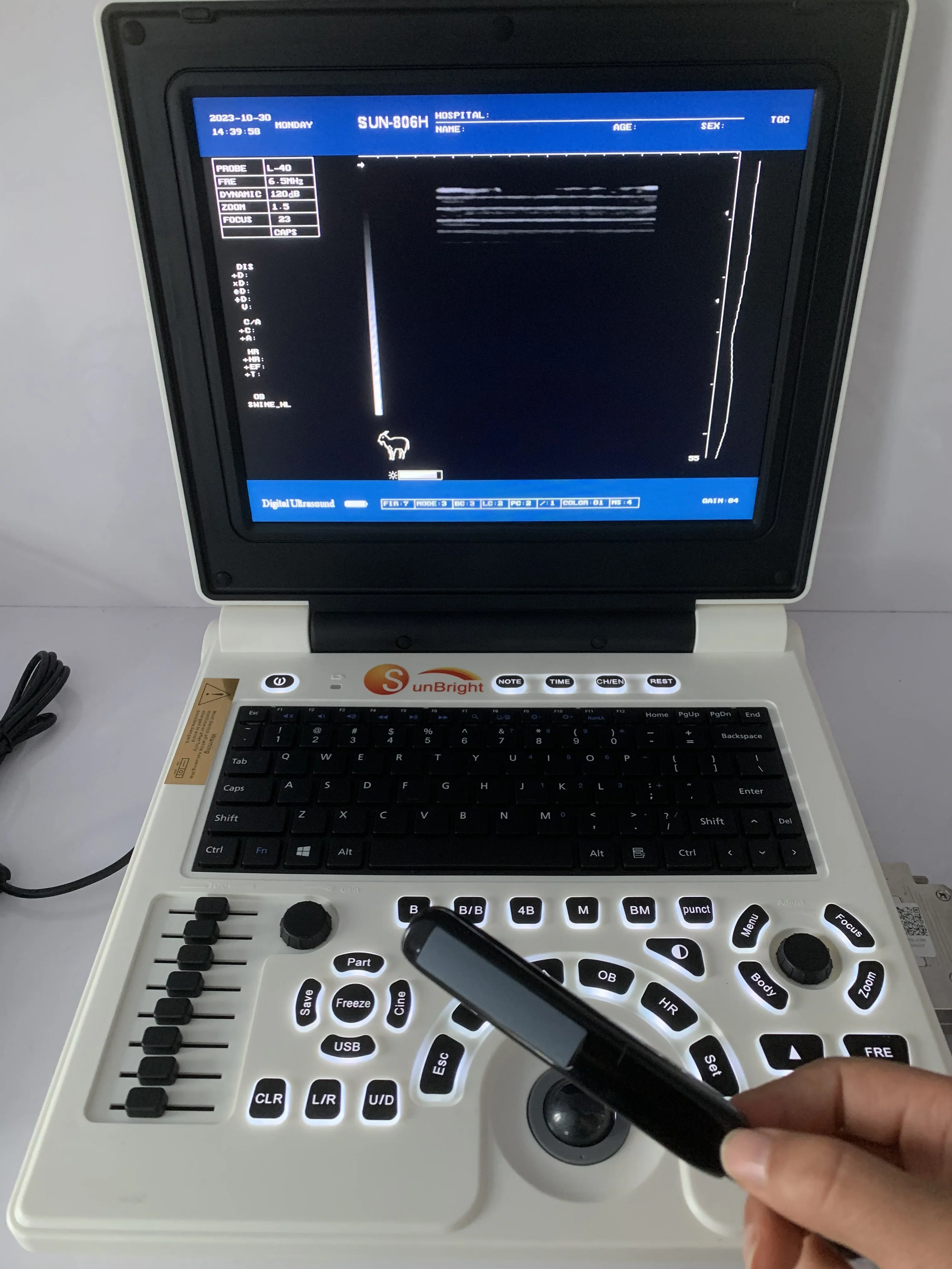 Medical laptop Wholesale Human ultrasound scanner machine Portable High Performance ultrasound device