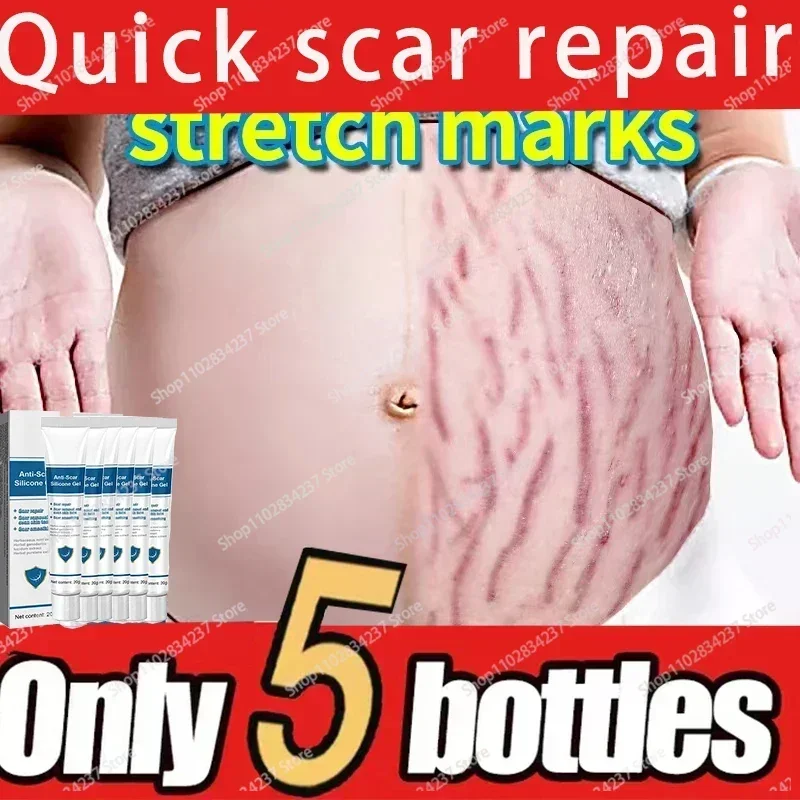 

Eliminate All Red White Old Stretch Marks Cream For Pregnancy Postpartum Skin Care Gel