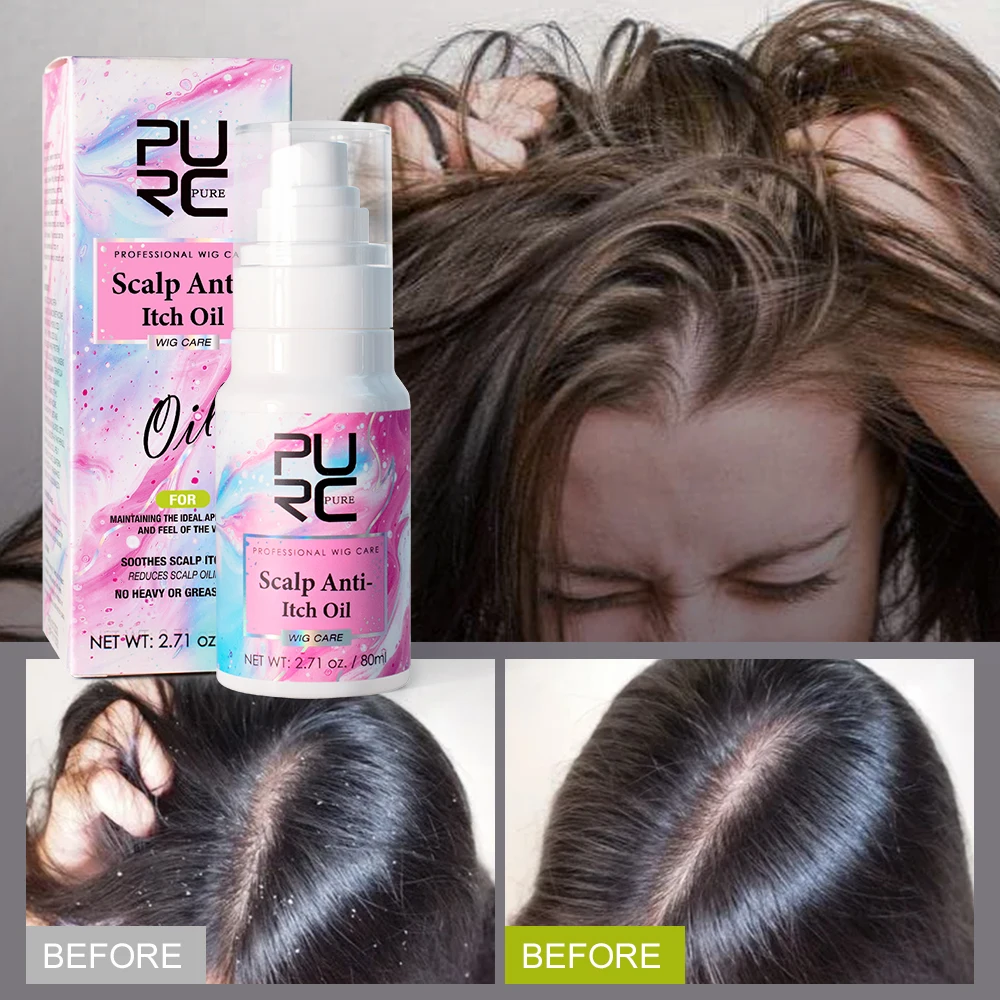 PURC Anti-Itch Oil Scalp Treatment Professional Wig Care Products for Human Wig Oil Control Anti-Dandruff Hair Care for Women