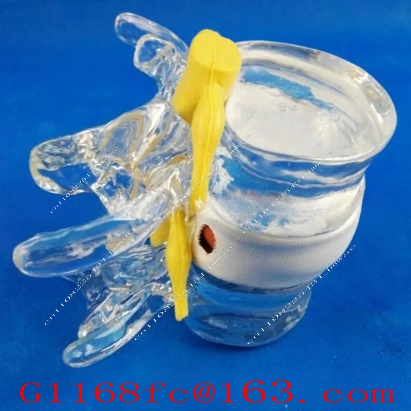 High Quality Human Lumbar Disc Compression Demonstration Model Spine