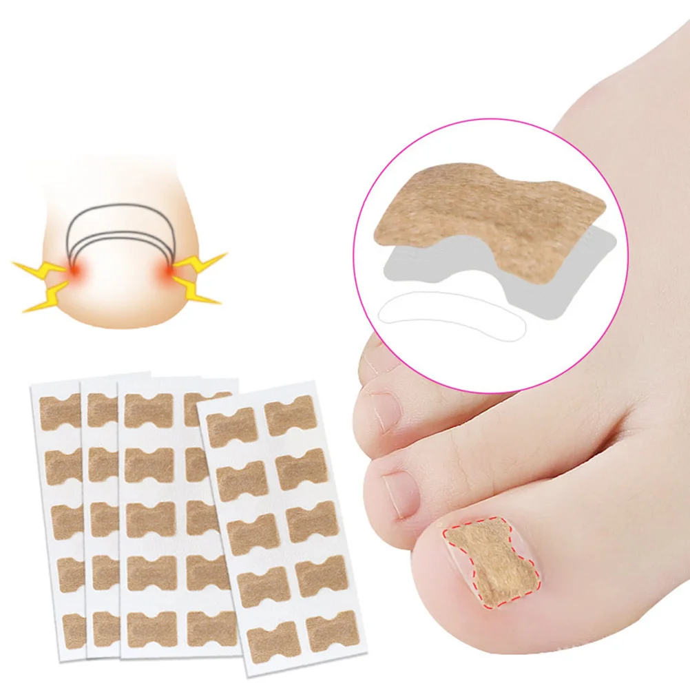 

Corrector Stickers Ingrown Nail Relief Patch For Paronychia Treatment Portable Foot Care Tool Wear Sandals Easily Ingrown