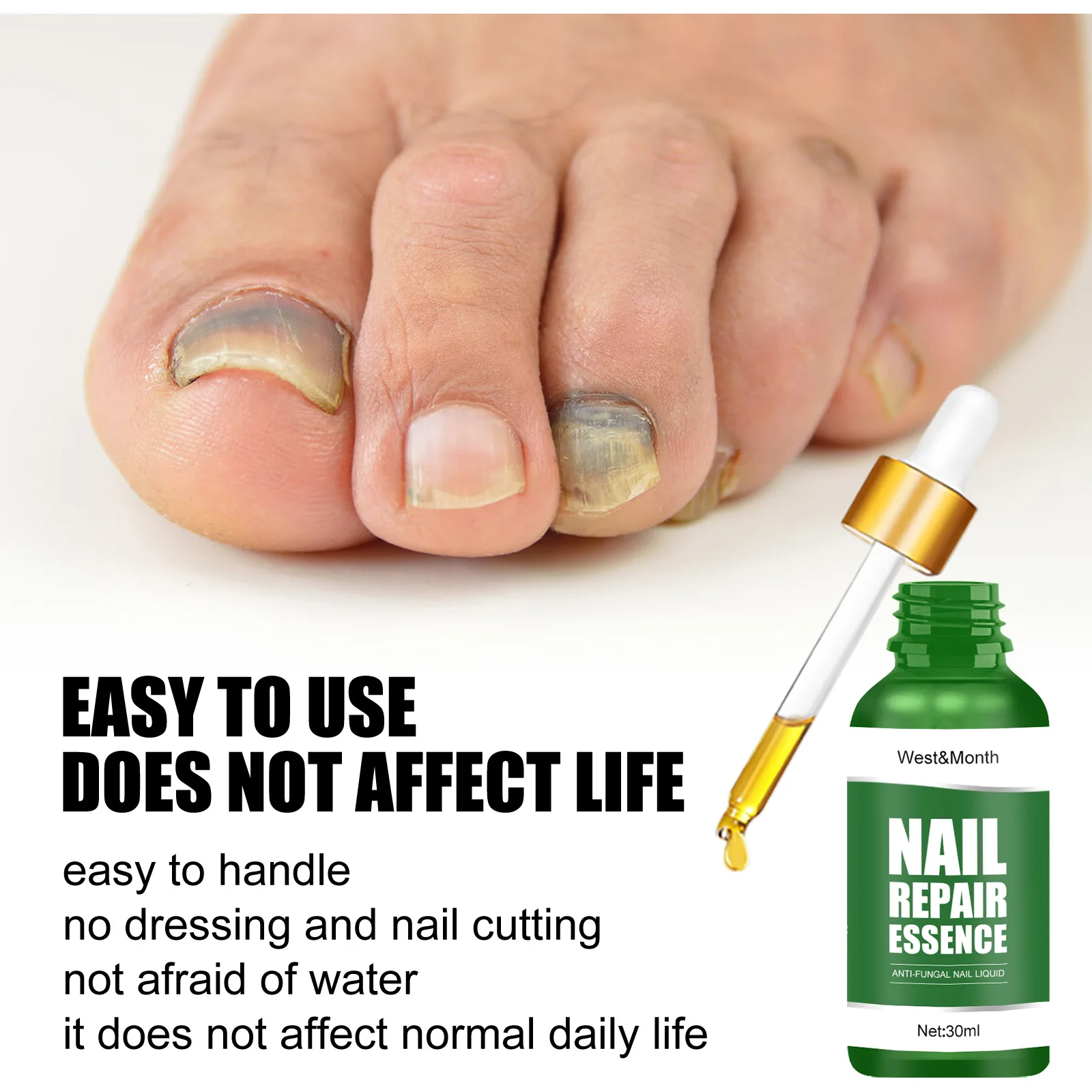 Nail Fungal Treatment Serum Anti Infection Gray Onychomycosis Removal Paronychia Whitening Toe Repairing Hand Foot Care Essence