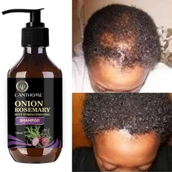 Anti-Hair Loss Onion Hair Shampoo para homens e mulheres, crescimento rápido do cabelo, eficaz em 7 dias, alecrim, crescimento do cabelo