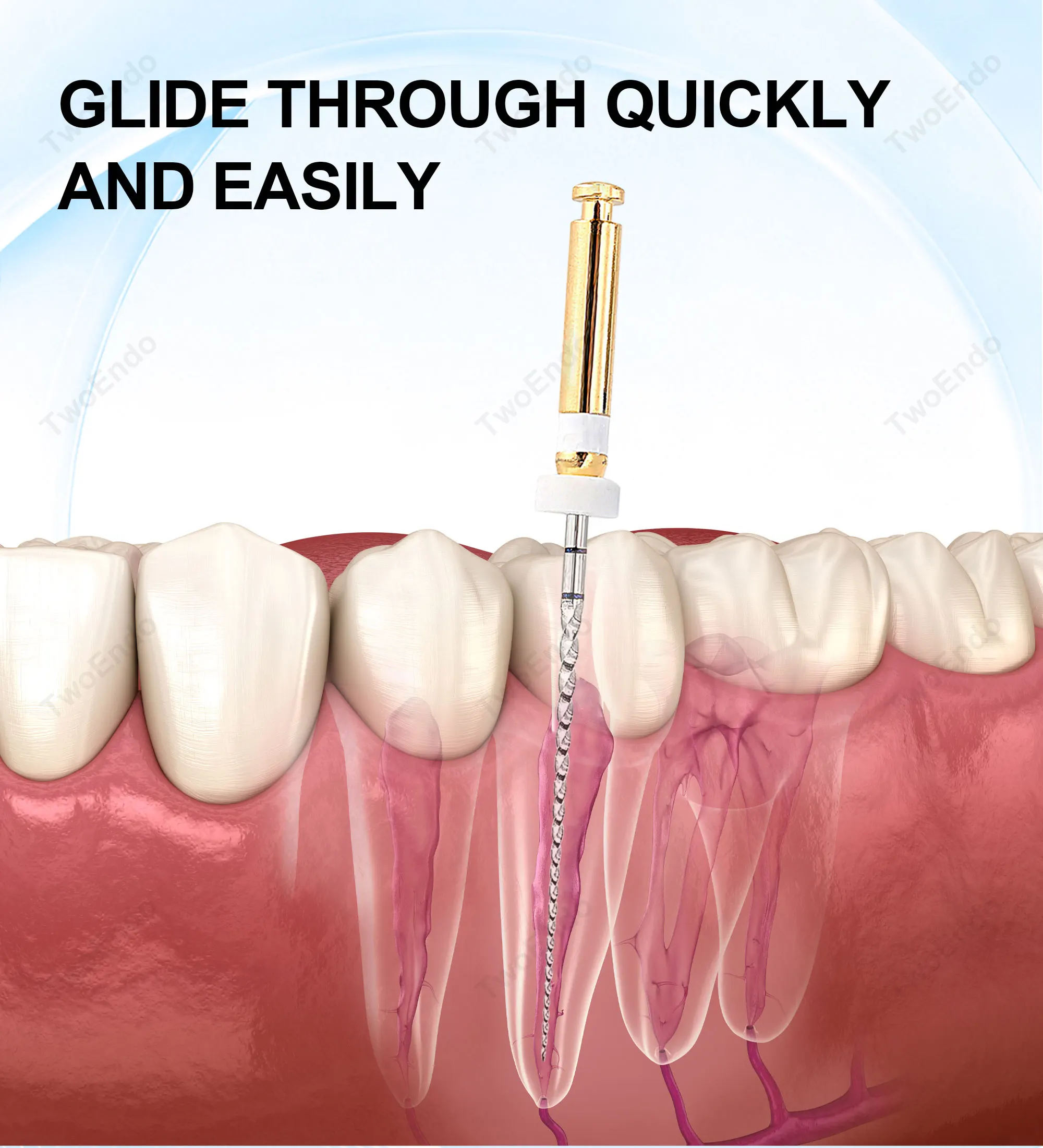 Twoendo Dental Endodontic Files 16/02 Glide Path Files 21/25mm Endo Rotary Files Glider Pathfinder Root Canal Materials
