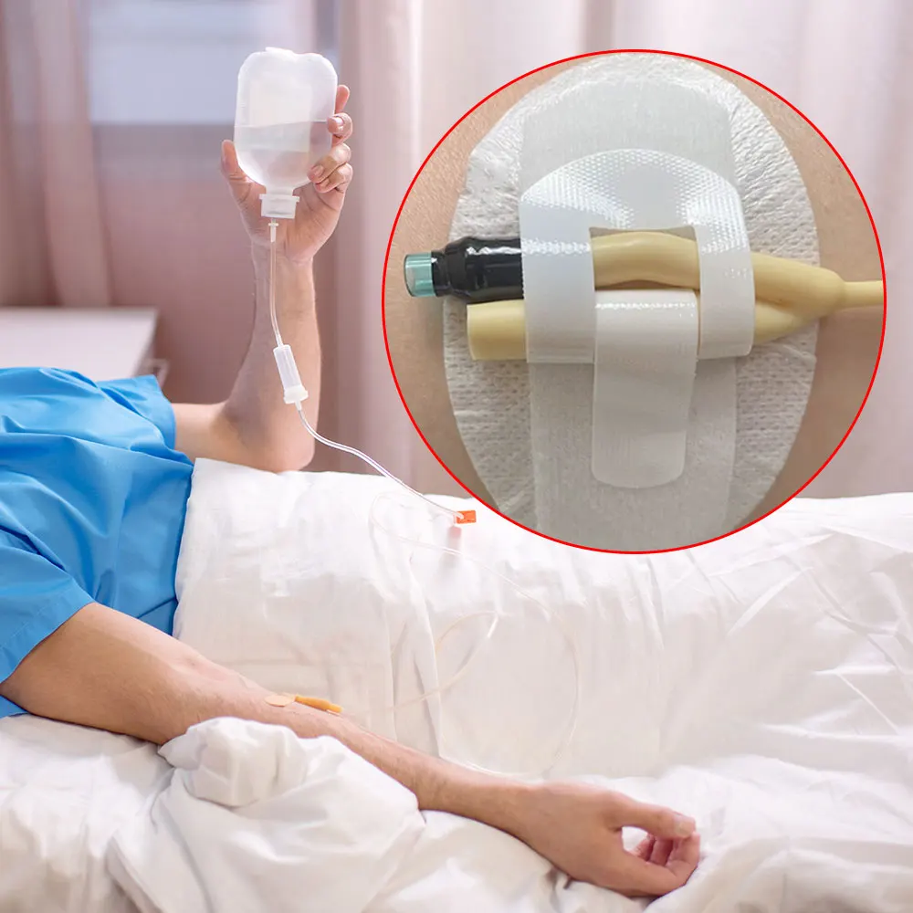 20-100pcs Catheter Stabilization Device Catheter Tube Holder Adhesive Urinary Catheter Holder Leg Bag Leg band Sticker Cover Kit