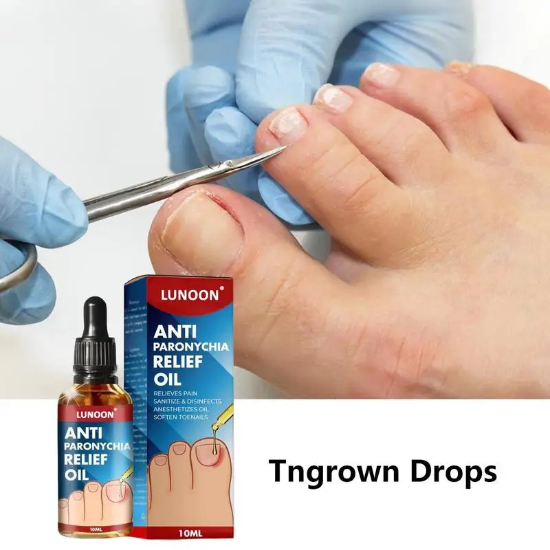 Drops For Ingrown Toenails Ingrown Toenail Relief Oil Essential Oil Solution For Ingrown Toenails To Soften And Soothe Nails