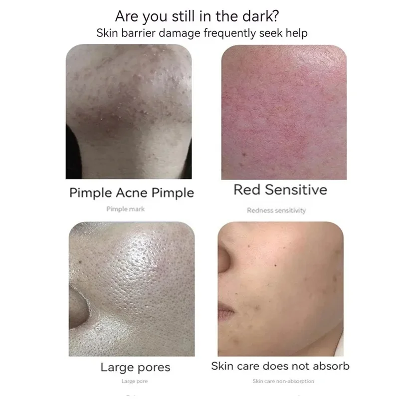 Thumbnail 4 - #35 Best Acne Treatments & Kits to Buy In 2026