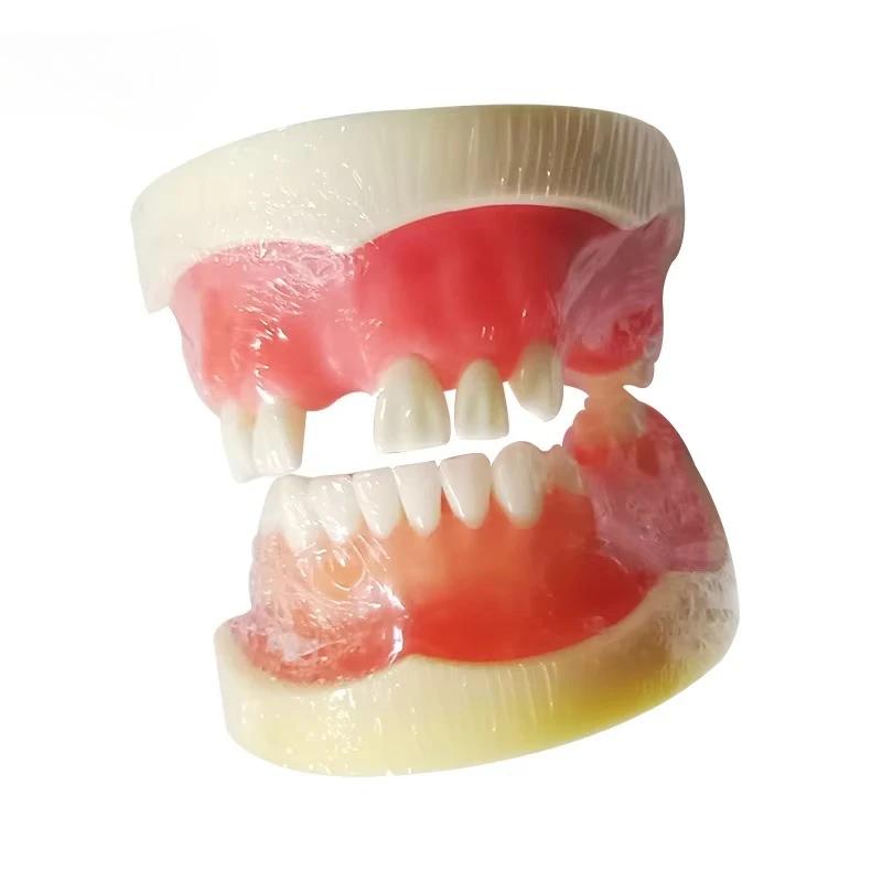 ImplantS Models Partially Edentulous Models Can Be Made with Incisions and Sutures