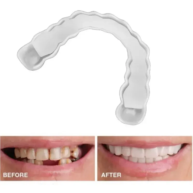 Sdotter Perfect Fit Teeth Whitening Fake Tooth Cover Snap On Silicone Smile Veneers Teeth Upper Beauty Tool Cosmetic Teeth Free