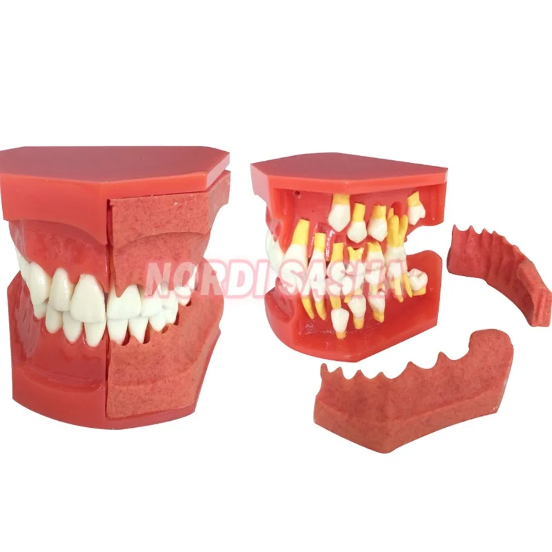 

1 шт., модель зубов для обучения зубами, детские первичные и постоянные зубы, альтернативная модель, замена молока и постоянных зубов